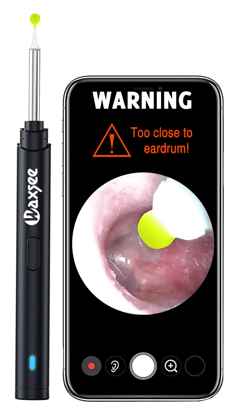 Ear wax Camera Ireland